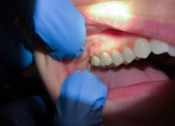 Best Urgent Dental Care for Toothache in Kingsley, MI